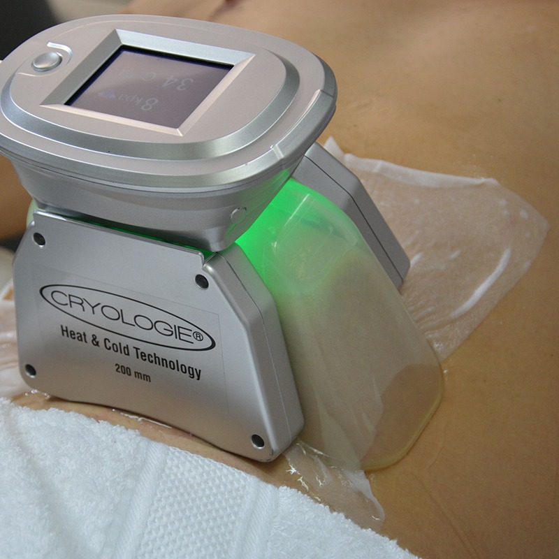 Soin cryolipolyse (45 à 60 min)